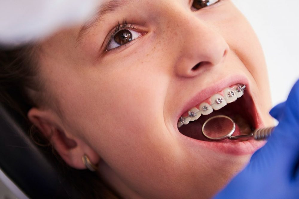 Orthodontics in Itasca, IL